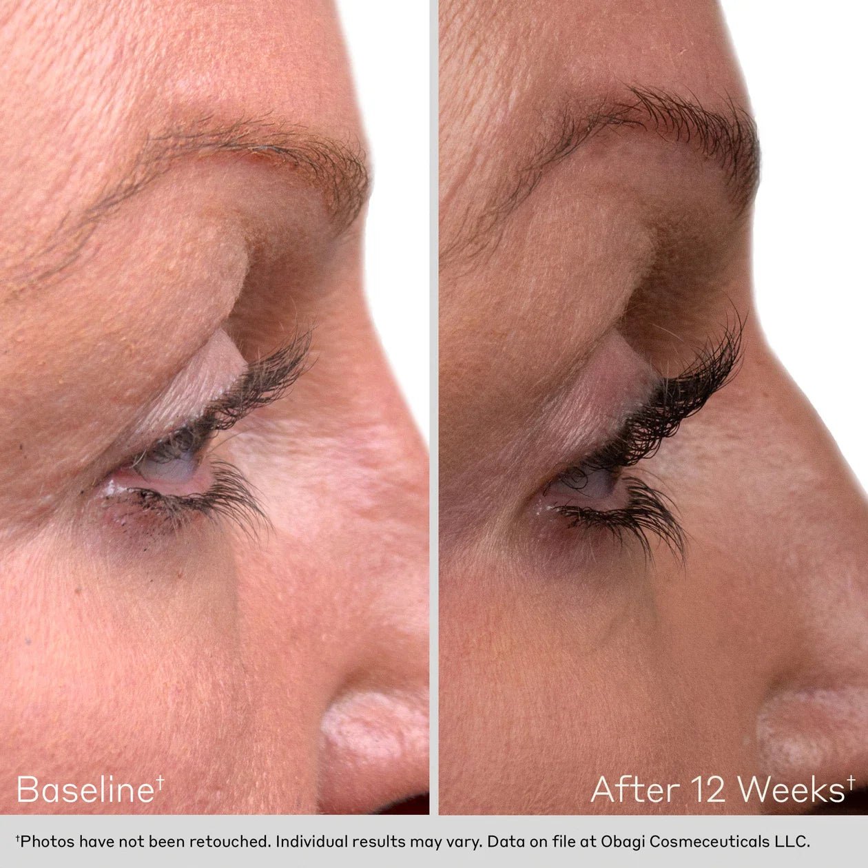 Obagi Nu - Cil Duo Eyelash + Eyebrow Serum - Harben House - Obagi Medical