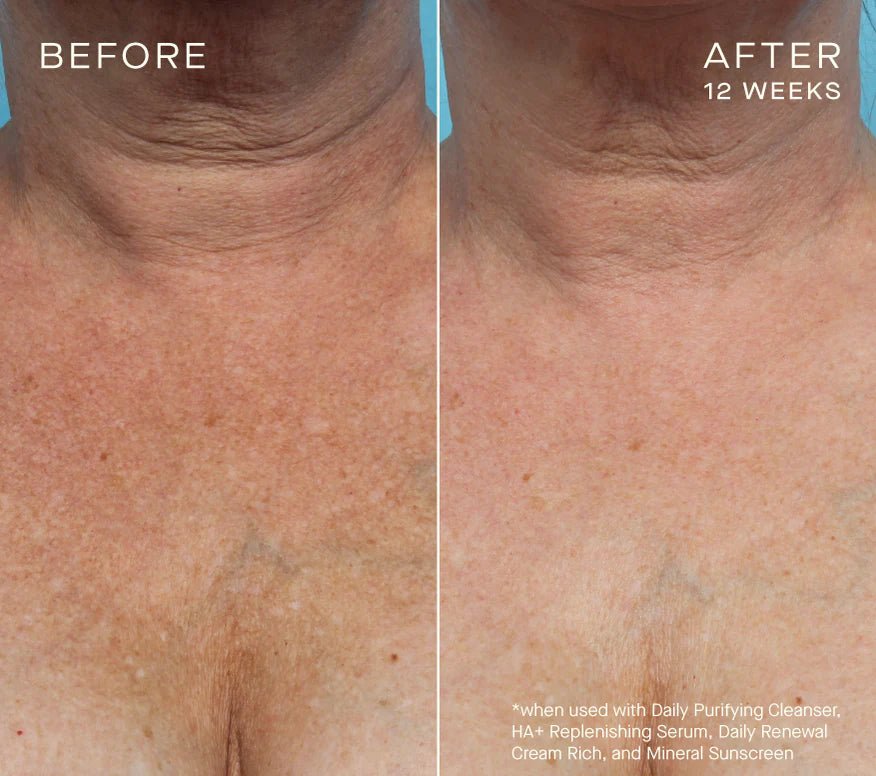 Ourself HA+ Replenishing Serum - Harben House - Ourself