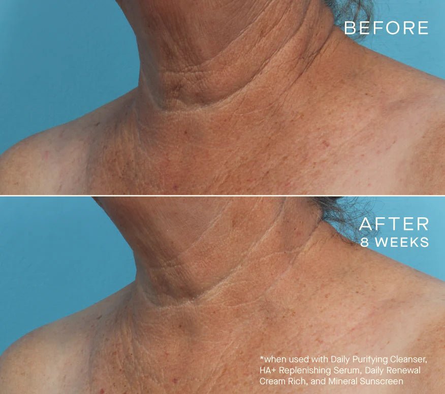 Ourself HA+ Replenishing Serum - Harben House - Ourself