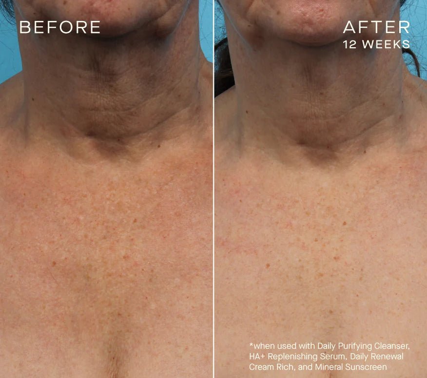 Ourself HA+ Replenishing Serum - Harben House - Ourself