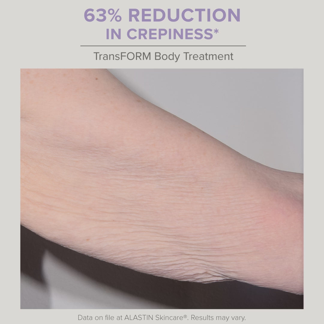 Load video: Alastin Skincare TransFORM Body Treatment