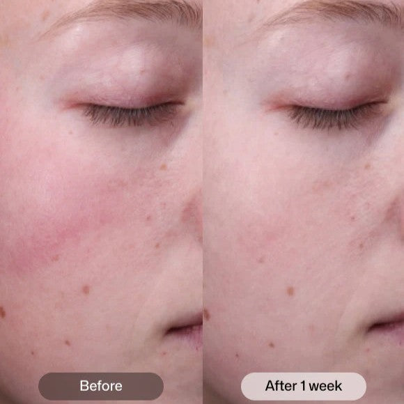 Revision Skincare Radiance+ Resurfacing Serum
