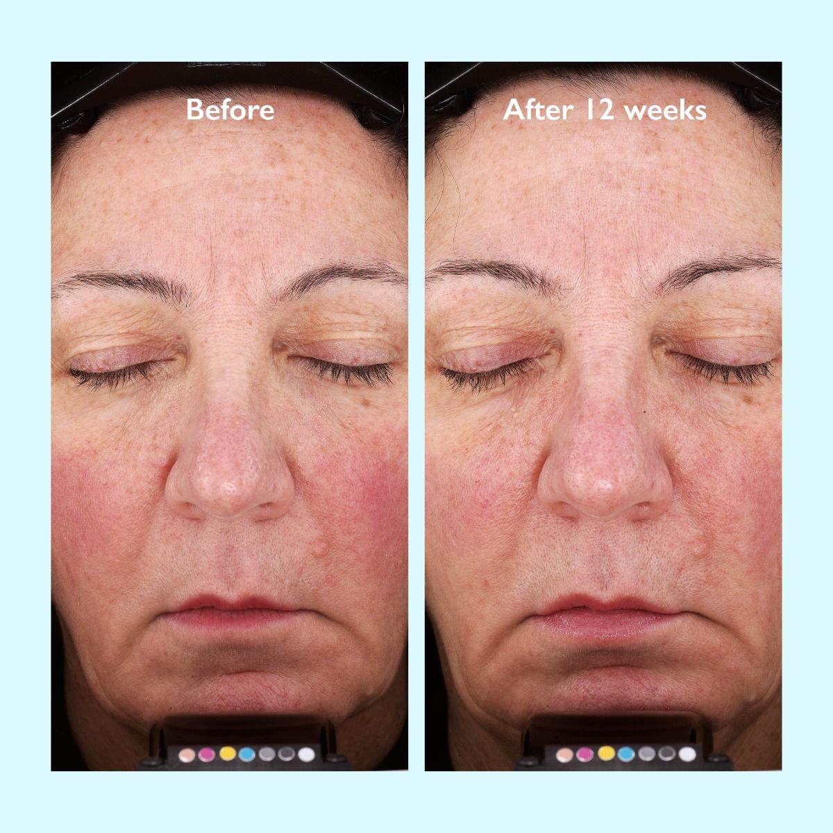 Restorsea PRO Rebalancing Lotion - Harben House - Restorsea PRO