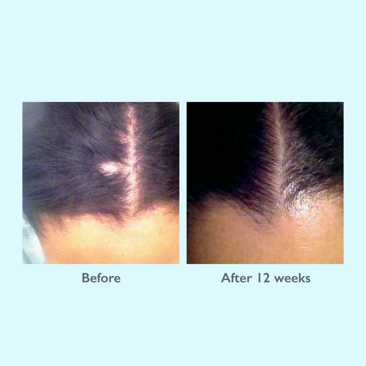Restorsea PRO Revitalizing Scalp Treatment - Harben House - Restorsea PRO