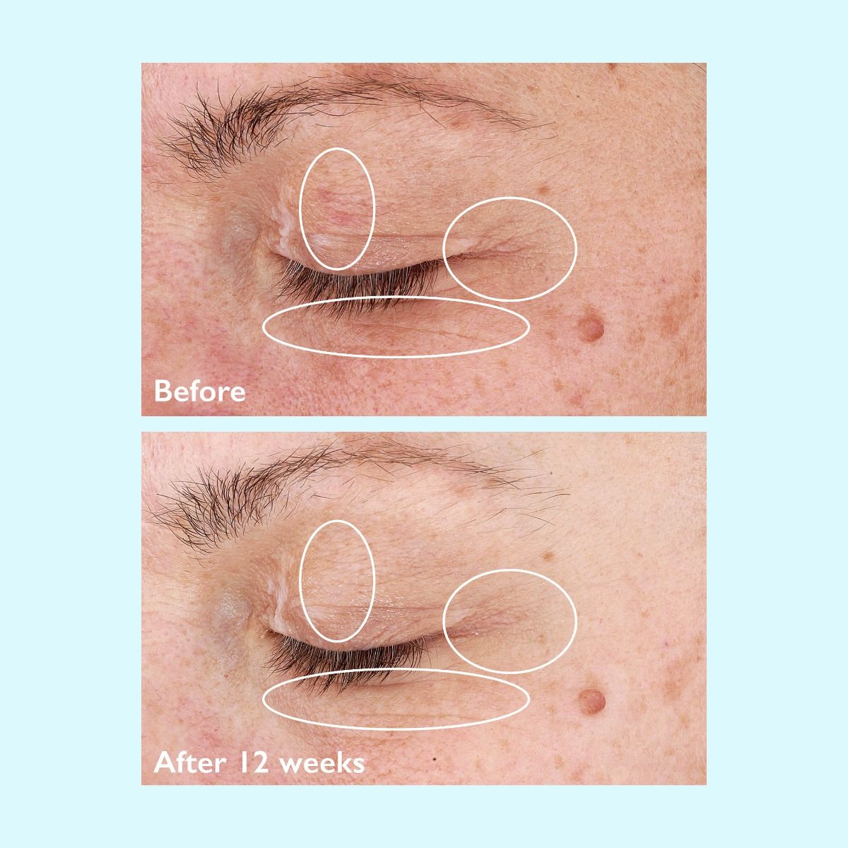 Restorsea Revitalizing Eye Cream - Harben House - Restorsea