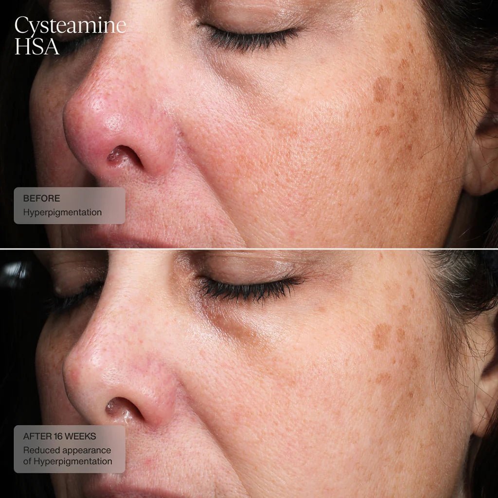 Senté Cysteamine HSA Pigmentation & Tone Corrector - Harben House - SENTE