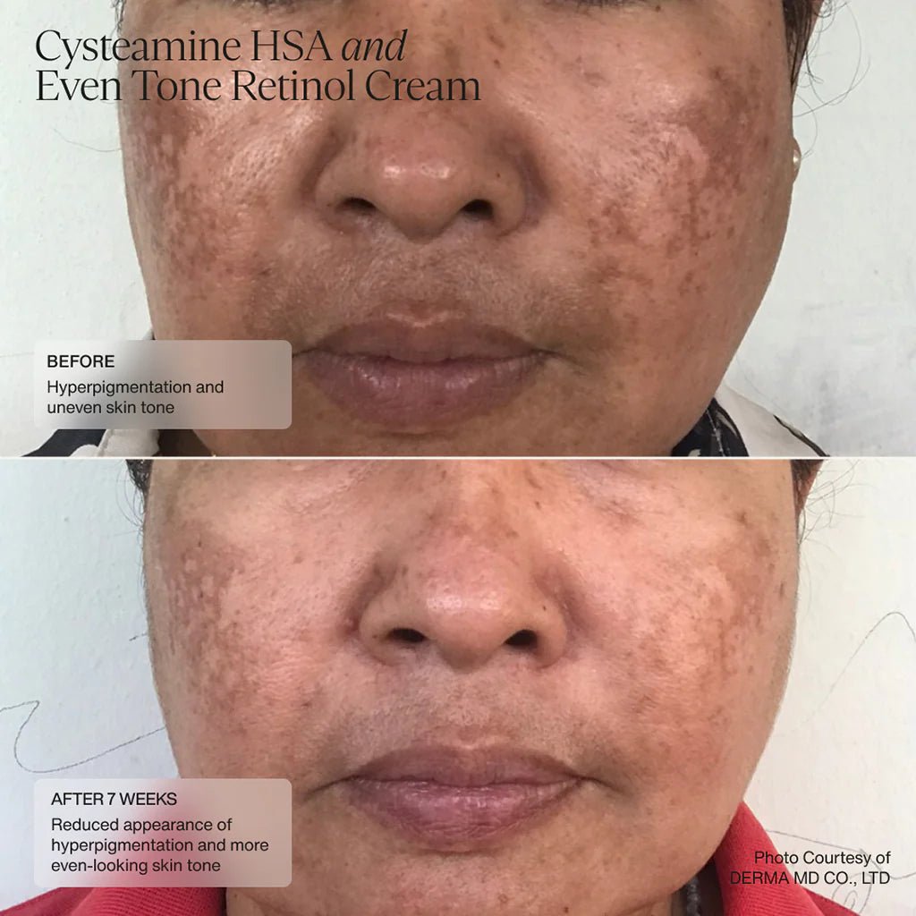 Senté Cysteamine HSA Pigmentation & Tone Corrector - Harben House - SENTE