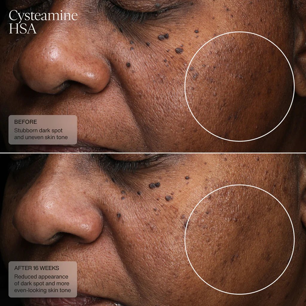 Senté Cysteamine HSA Pigmentation & Tone Corrector - Harben House - SENTE