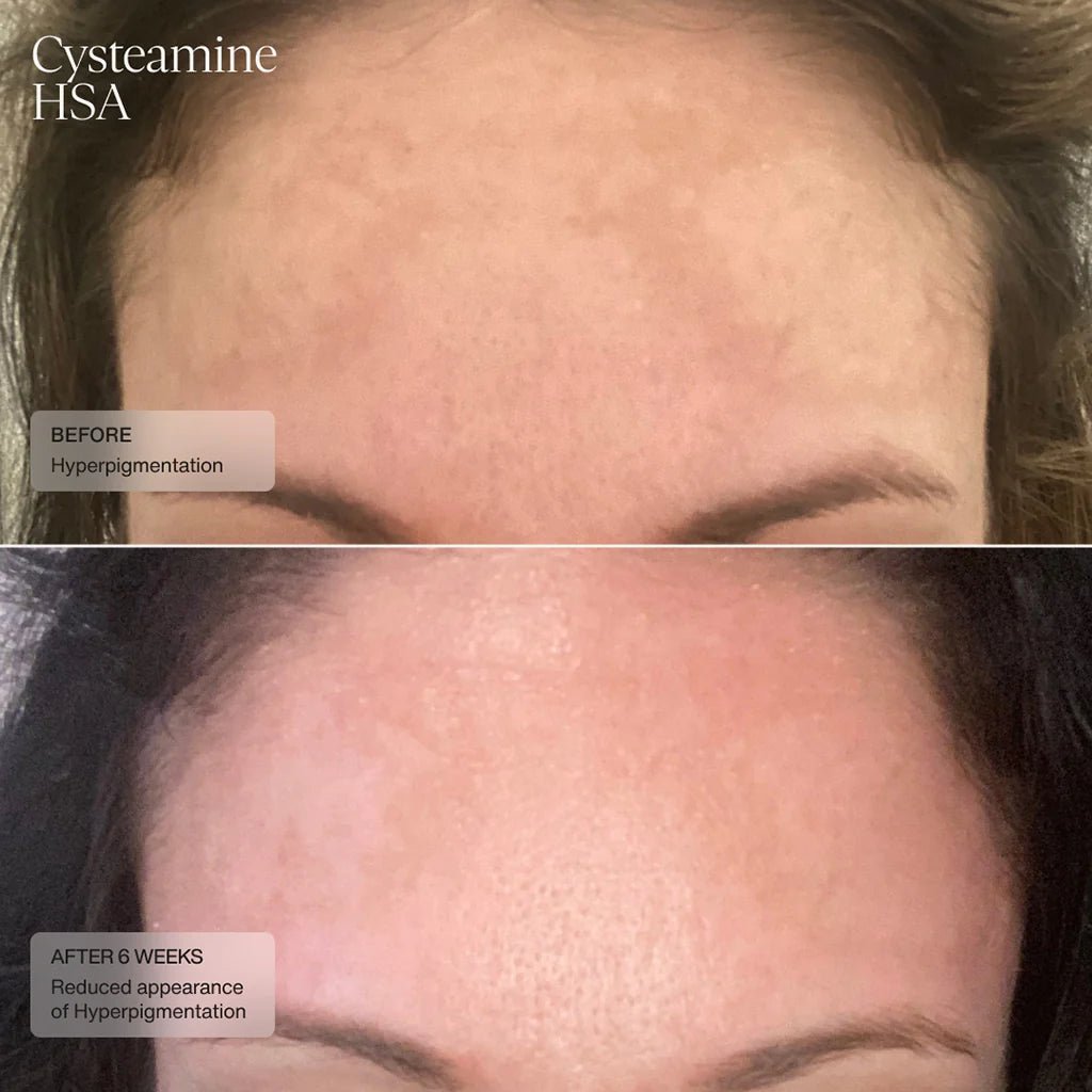 Senté Cysteamine HSA Pigmentation & Tone Corrector - Harben House - SENTE