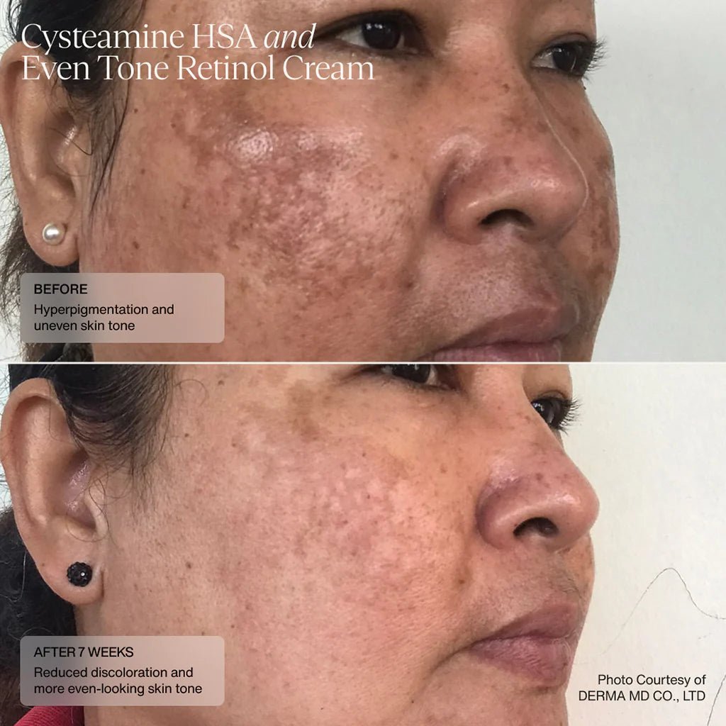 Senté Cysteamine HSA Pigmentation & Tone Corrector - Harben House - SENTE