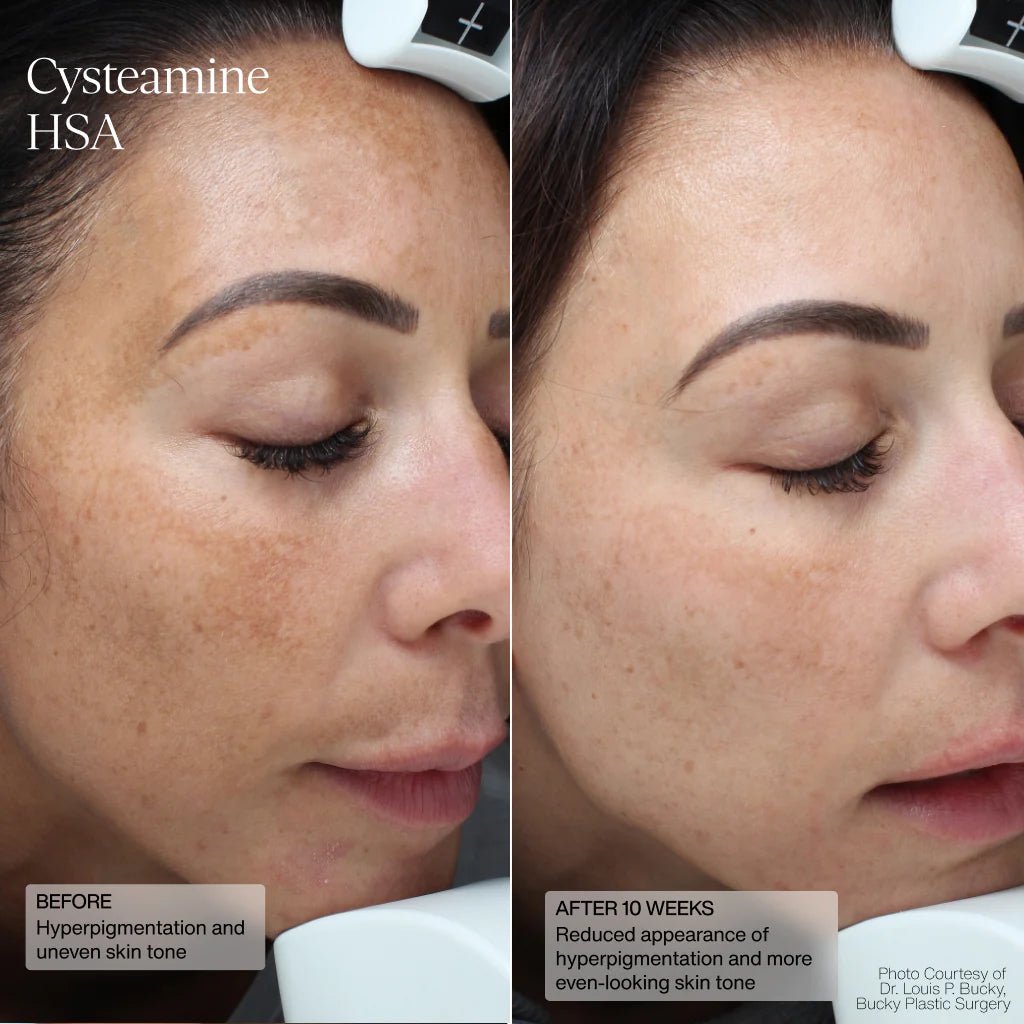 Senté Cysteamine HSA Pigmentation & Tone Corrector - Harben House - SENTE