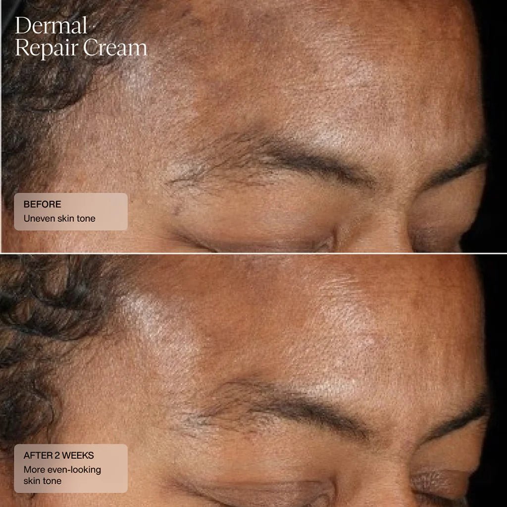 SENTÉ Dermal Repair Cream - Harben House - SENTE