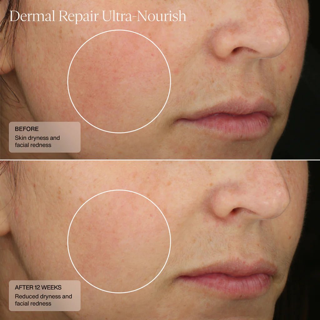 SENTÉ Dermal Repair Ultra - Nourish Creme - Harben House - SENTE