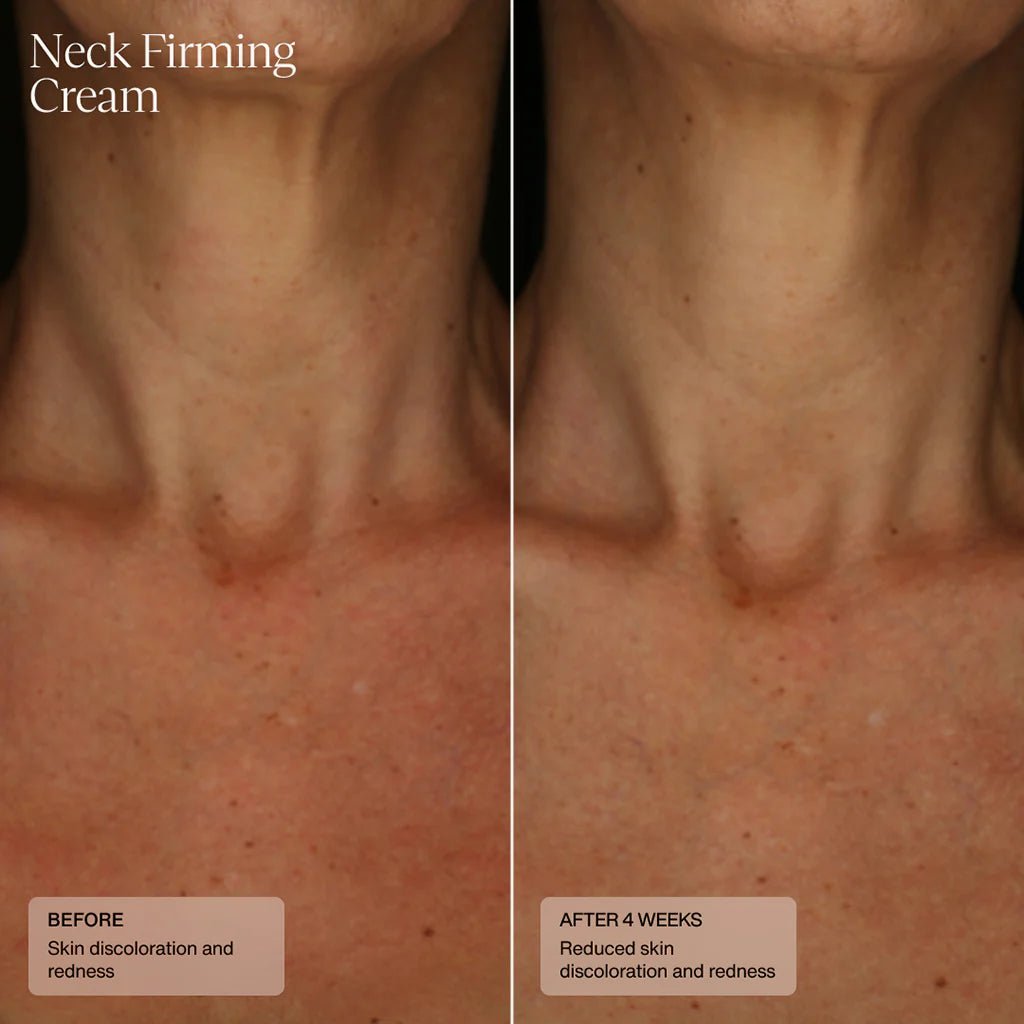 SENTÉ Neck Firming Cream - Harben House - SENTE