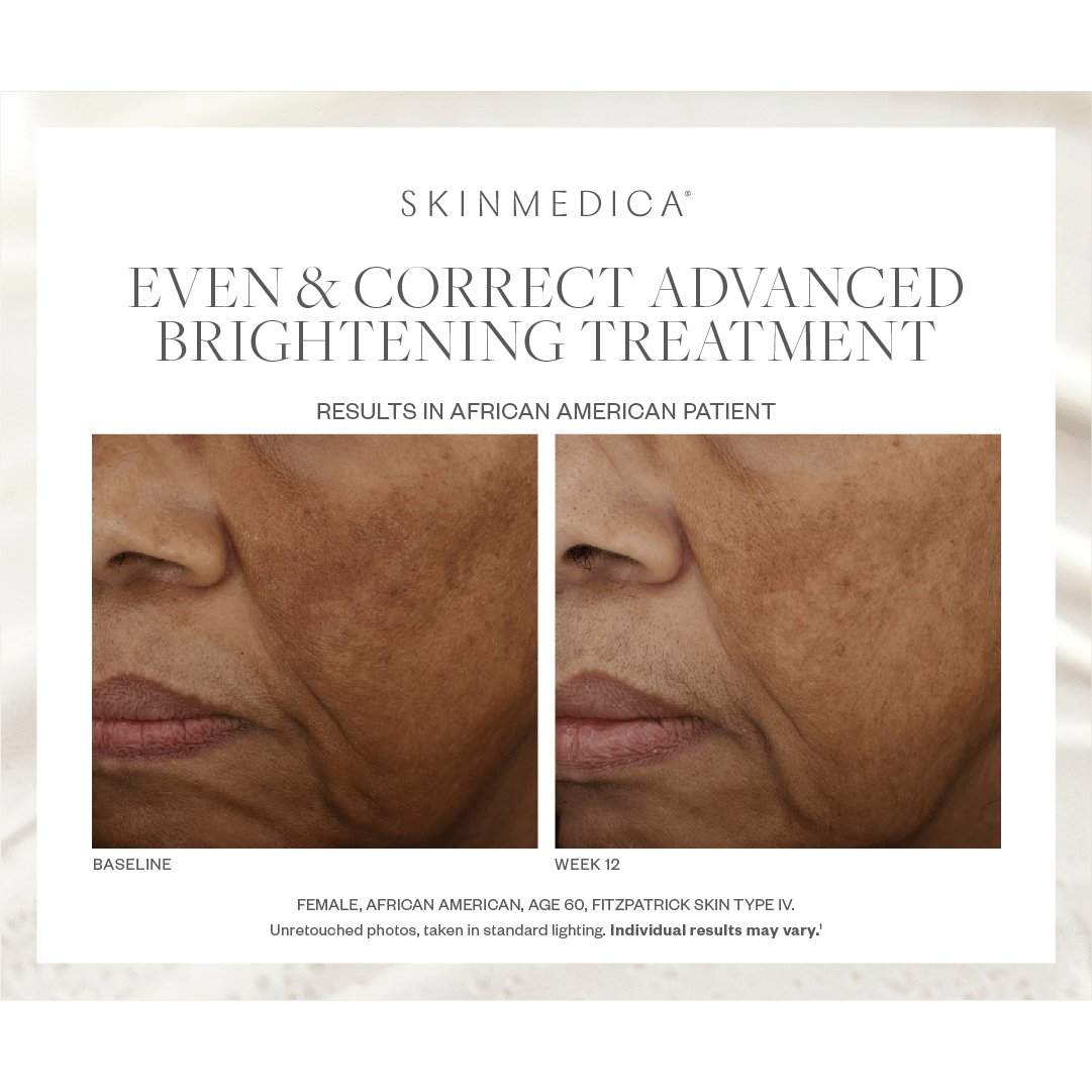 SkinMedica Even & Correct Advanced Brightening Treatment - Harben House - SkinMedica