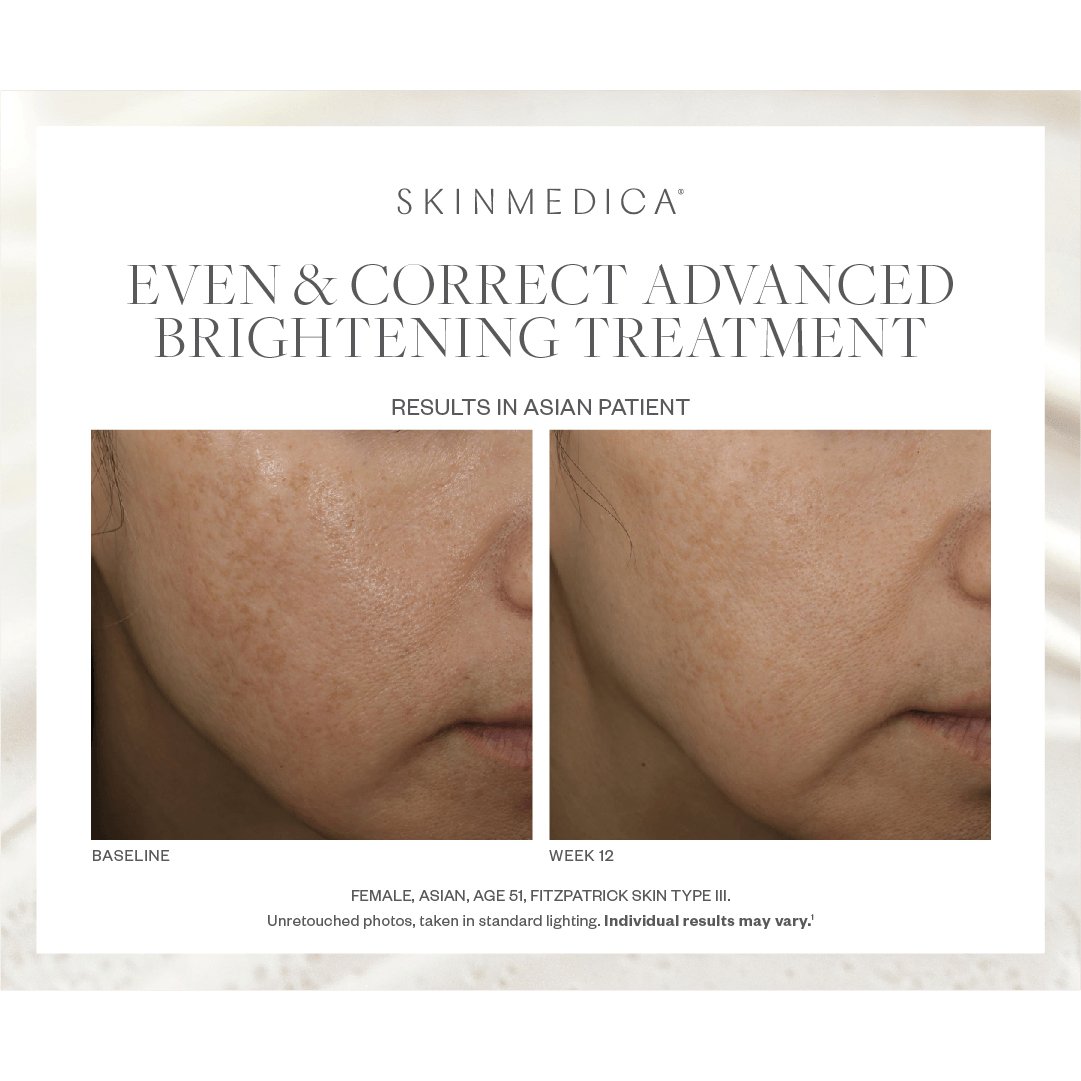 SkinMedica Even & Correct Advanced Brightening Treatment - Harben House - SkinMedica