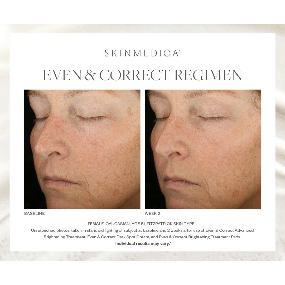 SkinMedica Even & Correct Advanced Brightening Treatment - Harben House - SkinMedica