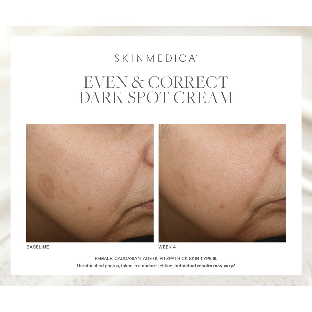 SkinMedica Even & Correct Dark Spot Cream - Harben House - SkinMedica