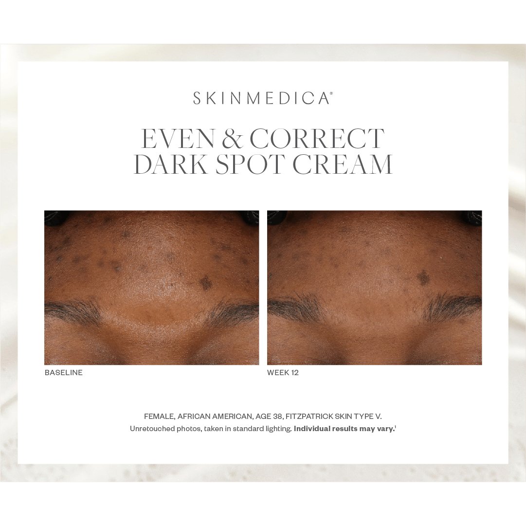 SkinMedica Even & Correct Dark Spot Cream - Harben House - SkinMedica