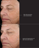SENTÉ Even Tone Retinol Cream Before and After 8 Weeks