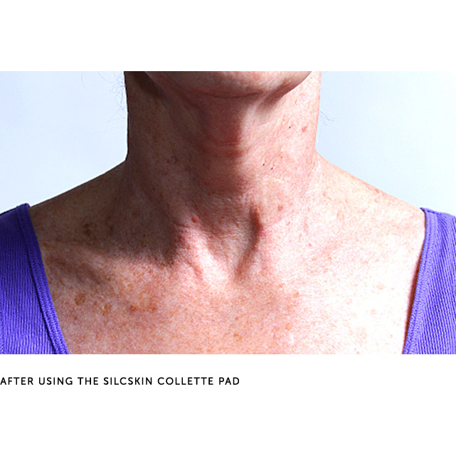 SilcSkin Collette After Use -Smooth and Lifted Neck