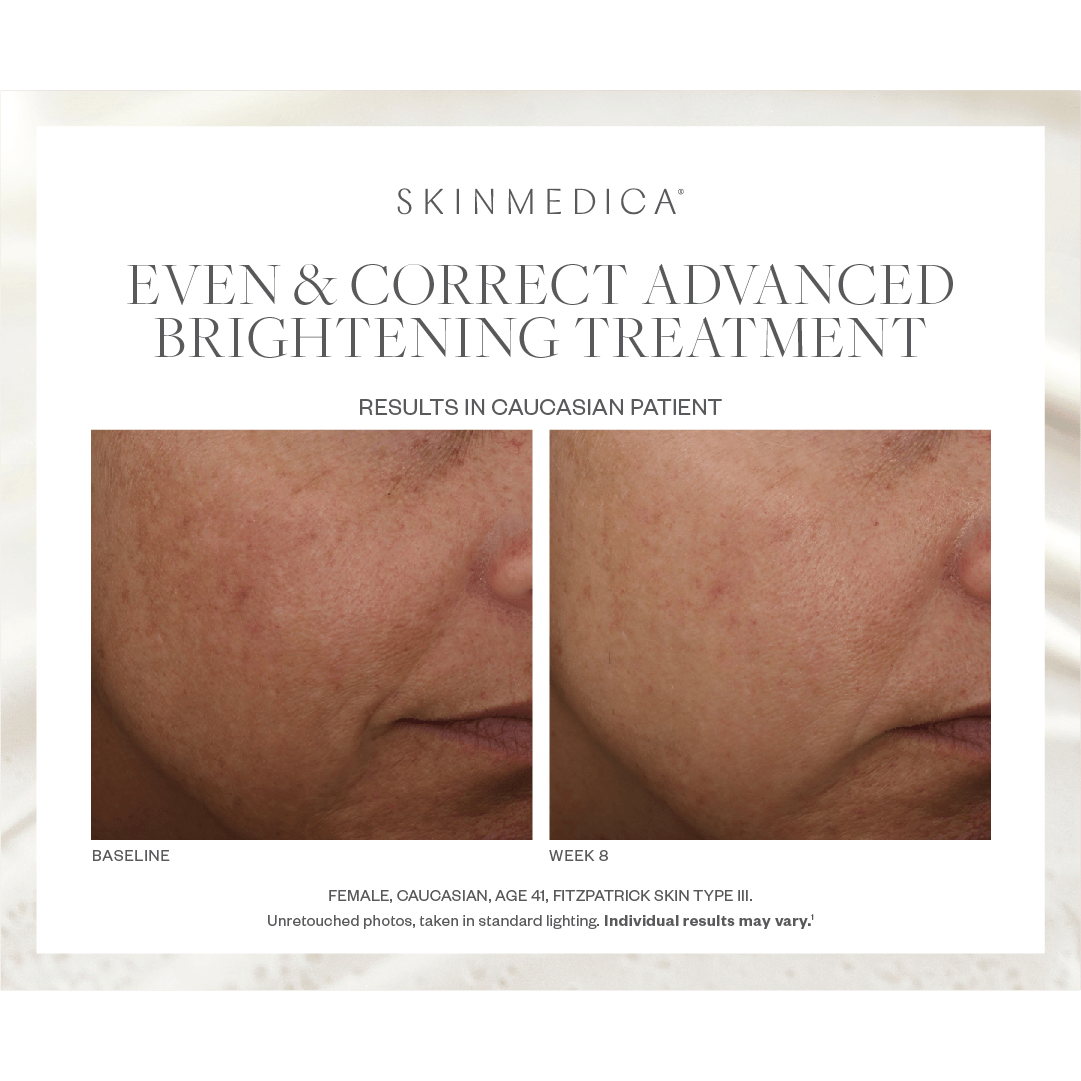 SkinMedica Even & Correct Advanced Brightening Treatment - Harben House