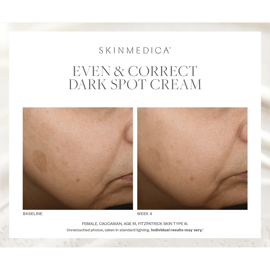 SkinMedica Even & Correct Dark Spot Cream - Harben House