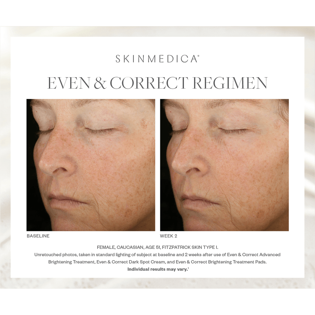 SkinMedica Even & Correct Brightening Treatment Pads - Harben House